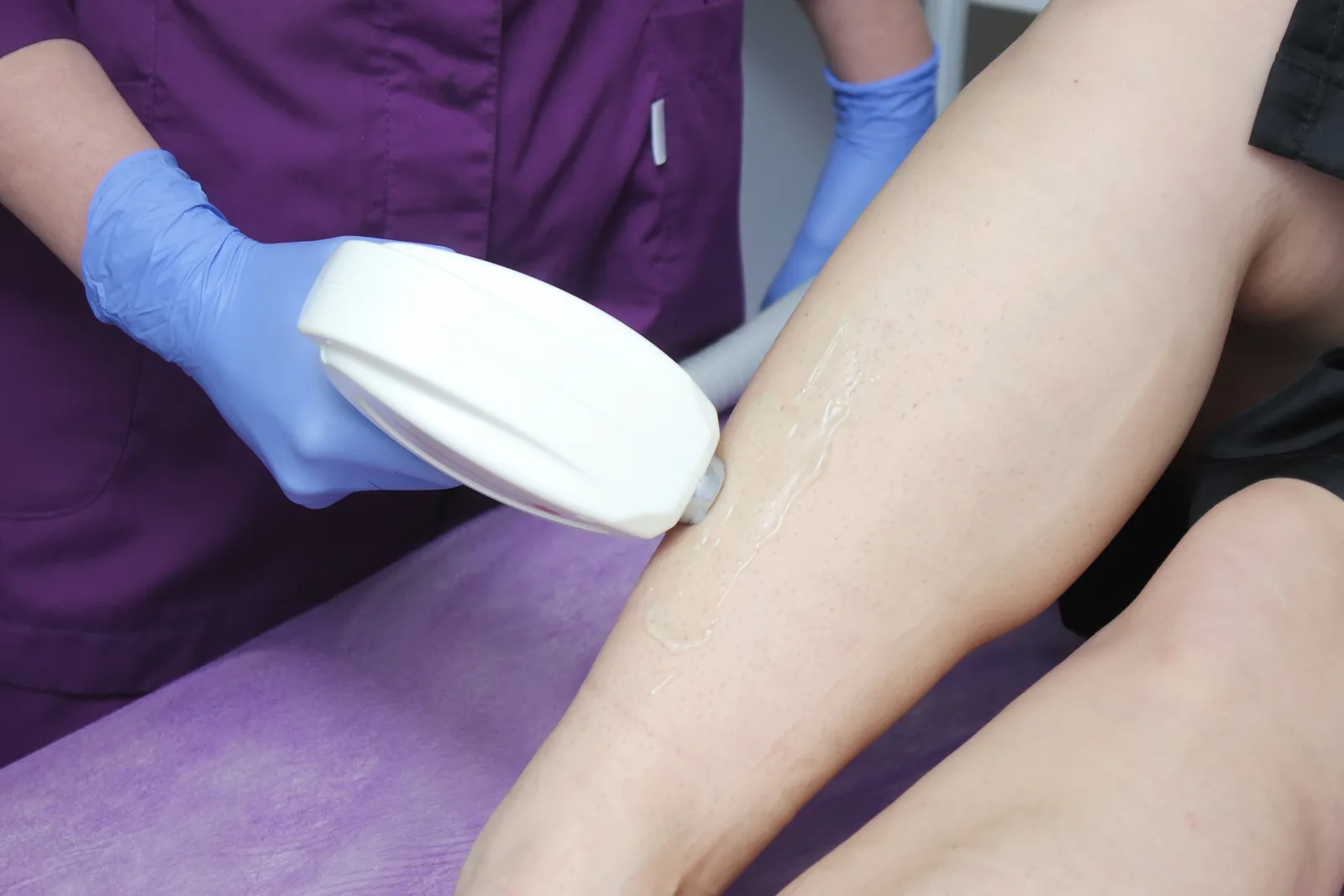 Chronic Venous Insufficiency Ayurvedic Treatment: Is it