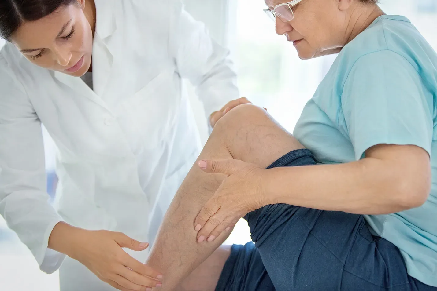 How Long for Spider Veins to Disappear After Laser
