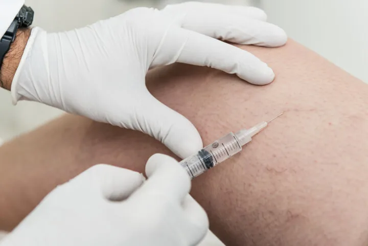 sclerotherapy for varicose veins performed by professional vein doctor